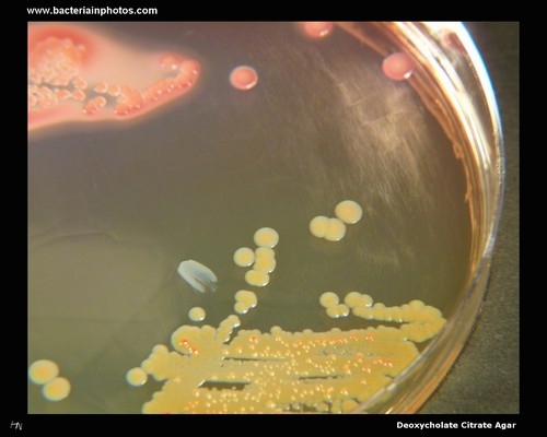 deoxycholate citrate agar lactose fermentation